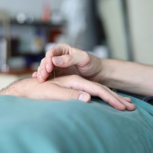 Therapist using acupuncture needles on patients hand