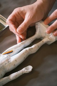 Acupuncture used on a small figure
