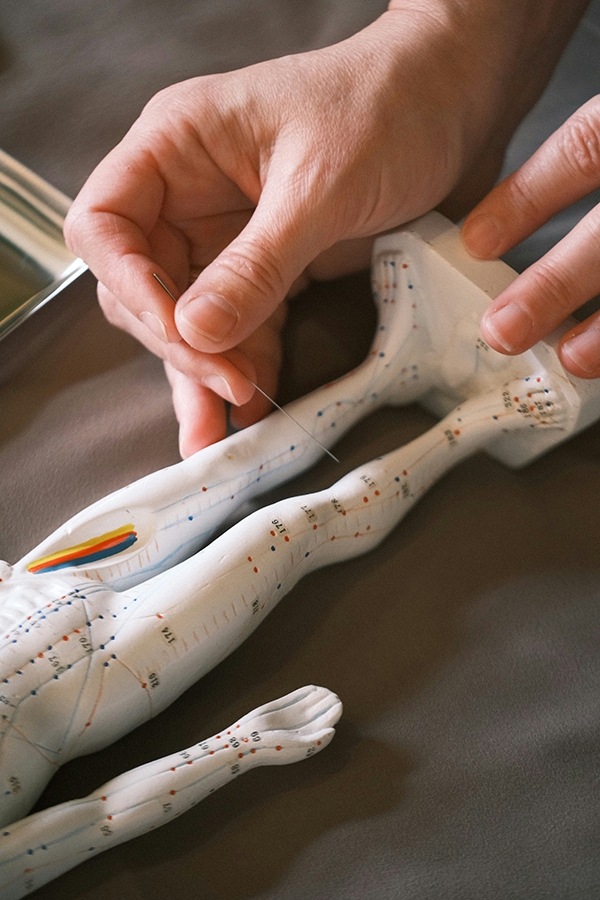 acupuncture-600-1 Acupuncture used on a small figure